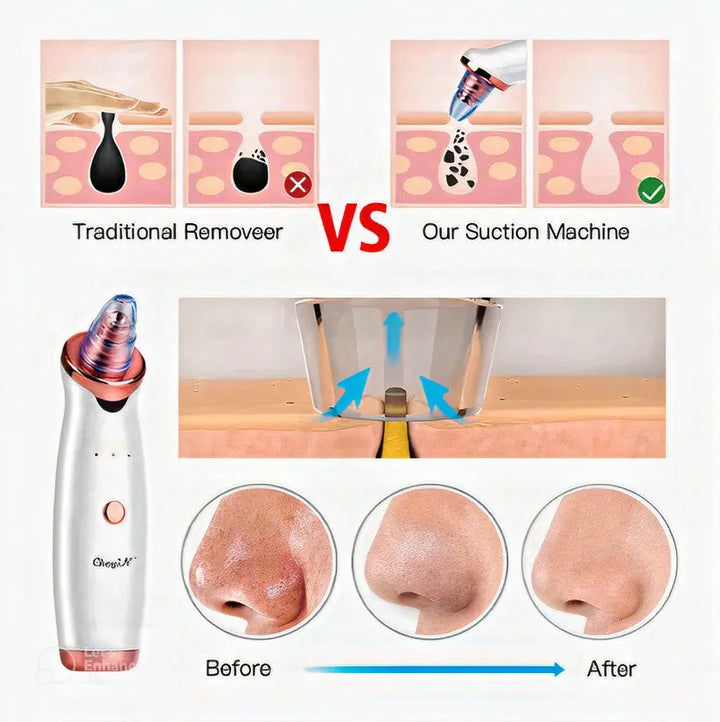 Electric Blackhead Pore Cleaning Beauty Instrument Glossy.pk