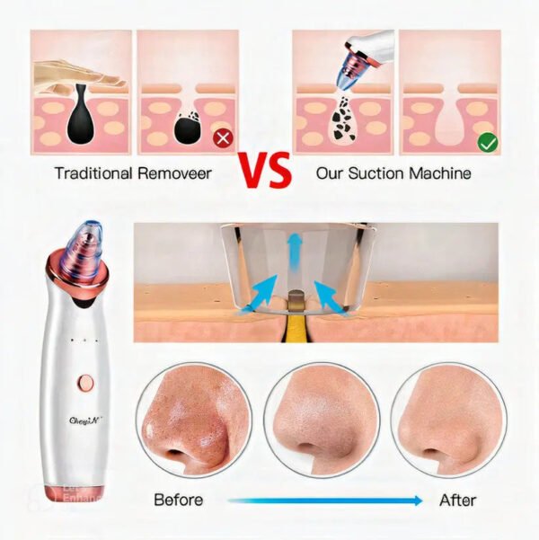 USB Electric Blackhead Remover (Ultrasonic Vibration) product photo 3 | Glossy.pk Pakistan
