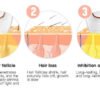 Glossy Pocket IPL Laser Hair Removal Device anti-tarnish jewellery from Glossy.pk, Lahore
