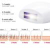 Glossy Pocket IPL Laser Hair Removal Device anti-tarnish jewellery from Glossy.pk, Lahore
