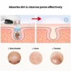 Glossy Aqua Vacuum Pore Cleaner | Mini Hydra Facial Device anti-tarnish jewellery from Glossy.pk, Lahore