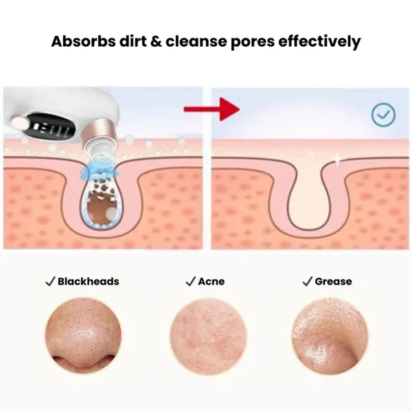 Glossy Aqua Vacuum Pore Cleaner | Mini Hydra Facial Device anti-tarnish jewellery from Glossy.pk, Lahore