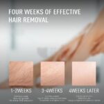 Glossy Sapphire ICE IPL Laser Hair Removal Device - Image 10