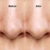 Glossy Aqua Vacuum Pore Cleaner (Mini Hydra Facial Device) product photo 4 | Glossy.pk Pakistan